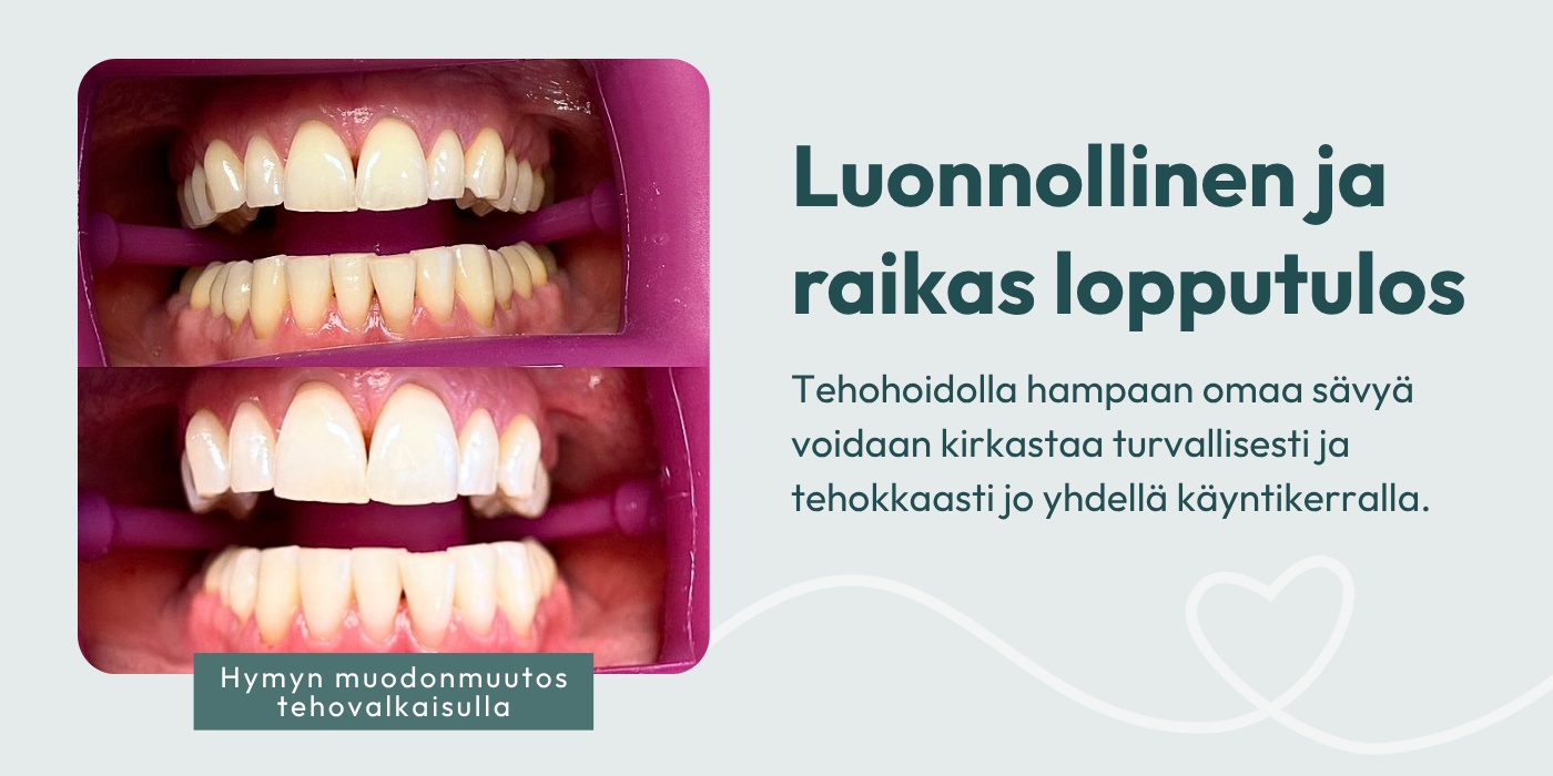 Tehovalkaisu ennen jälkeen verkkosivuille 1